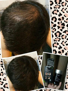 DEXE HAIR FIBER BALD SOLUTION